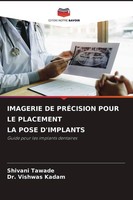 Imagerie De PrÉCision Pour Le Placement La Pose D'implants Shivani Tawade