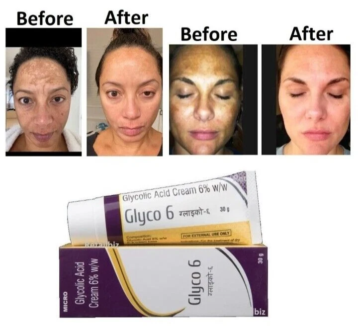 2 X Crème Demelan - Acide Glycolique & Kojique - Anti-taches, Hyperpigmentation - 20g Chaque