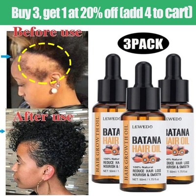 3Pcs Batana Oil Essence For Healthy Hair Growth Natural Anti Hair Loss Care 50ml