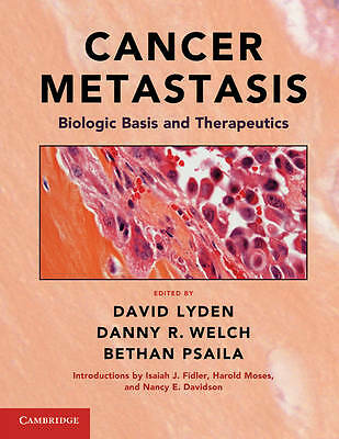 Cancer Metastasis Biologic Basis Therapeutics Hardcover Cambridge… 9780521887212
