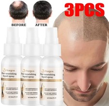 3PCS Hair Growth Spray, Grow Hair Fast, Hair Loss Treatment Serum for Men Women
