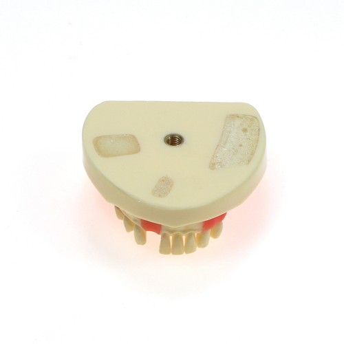 Dental Typodont Zahnmodell Implantat Pathologisch Perio Restauration Praxis Demo - Bild 45 von 312