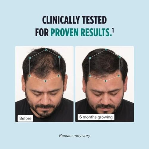 NUTRAFOL Men's Hair Growth Supplements Nutraceutical Dietary Authentic 120 Caps - Picture 6 of 10