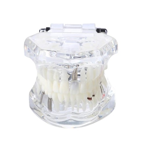Orthodontic Dental Metal Bracket in Orthodontic Typodont - China Metal