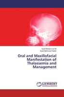 Syed Muhammad Ali (U. A.) | Oral And Maxillofacial Manifestation Of...