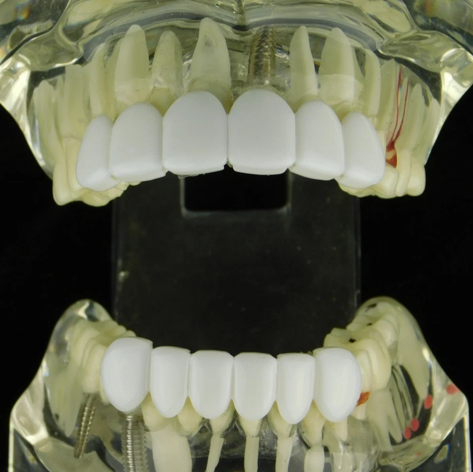 White Teeth Grillz Set Teeth Bright Smile Snap-On False Fake Grills Top & Bottom - Image 4 of 4