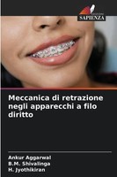 Meccanica Di Retrazione Negli Apparecchi A Filo Diritto Ankur Aggarwal (U. A.)