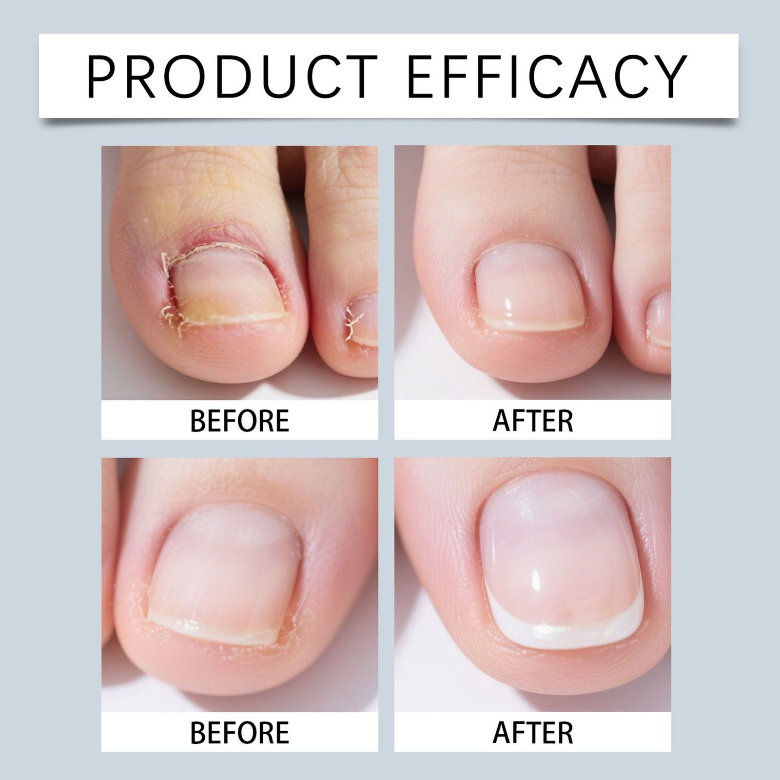 Nail Care Products 15ML Gentle Nourishing Solution Nail Care Drops