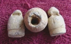 (3) DUG  CIVIL WAR PULLED/WORMED  BULLETS  (1) MINIE/(2) PISTOL   (VICKSBURG)