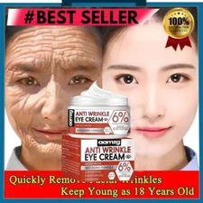 Retinol Eye Cream Instant Remove Eye Bags,Dark Circles Wrinkle Eye Depuffing NEW