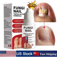Fungi-Nail Anti-Fungal Liquid Solution Kills Fungus That Can Lead To Nail