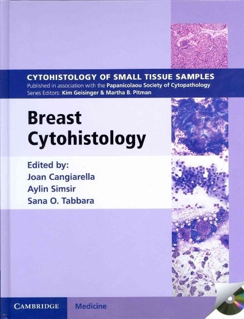 Breast Cytohistology with DVD-ROM Cangiarella Simsir Tabbara multi-part set