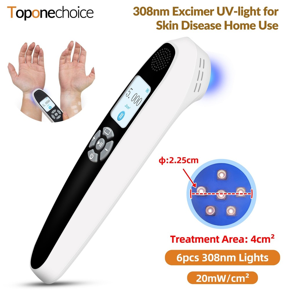 UVB 308nm Ultraviolet Light Therapy Device for Skin Diseases 20mW/cm² 6diodes