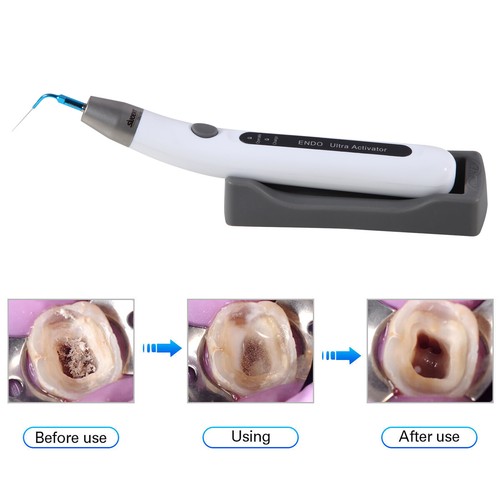 Attivatore dentale Endo Irrigatore ultrasonico Manipolo canale radicale /Tip - Imagen 6 de 15
