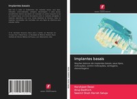 Implantes Basais Harshjeet Desai