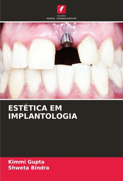 Kimmi Gupta (U. A.) | EstÉTica EM Implantologia | Taschenbuch | Portugiesisch-image