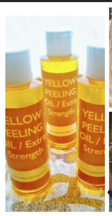 Yellow peeling oil  Extra strength - Image 4 of 4