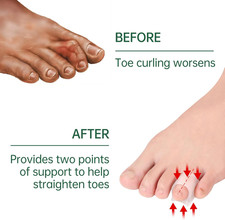 Gel Hammer Toe Corrector - Hammer Toe Straightener for Women and Men, Toe Pro...