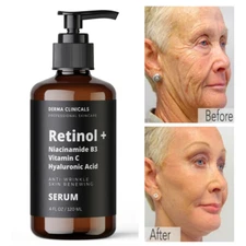 Retinol, Niacinamide, Vitamin C, Hyaluronic Acid, AntiAging Wrinkle SERUM - 4oz