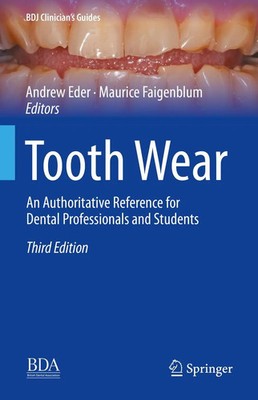 Andrew Eder (u. a.) | Tooth Wear | Buch | Englisch (2022) | xxii | Springer