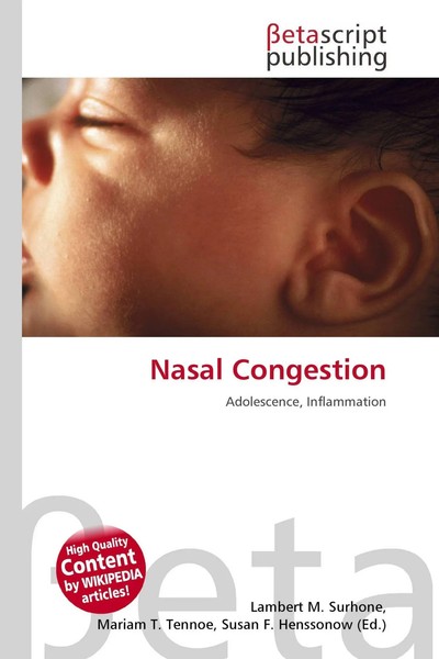 Lambert M. Surhone (U. A.) | Nasal Congestion | Taschenbuch | Englisch (2026)-image