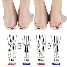 1 Pair Orthopedic Insole for OX Leg Correction Gel Massage Support Shoe Pad