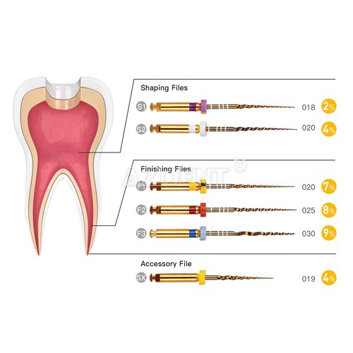 Cordless Dental LED Endo Motor 16:1 /Apex Locator /Endodontic Root Rotary Files - Picture 33 of 35