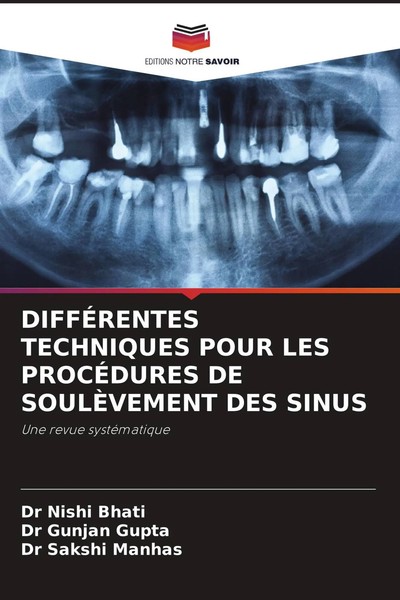 DiffÉRentes Techniques Pour LES ProcÉDures DE SoulÈVement DES Sinus Taschenbuch-image