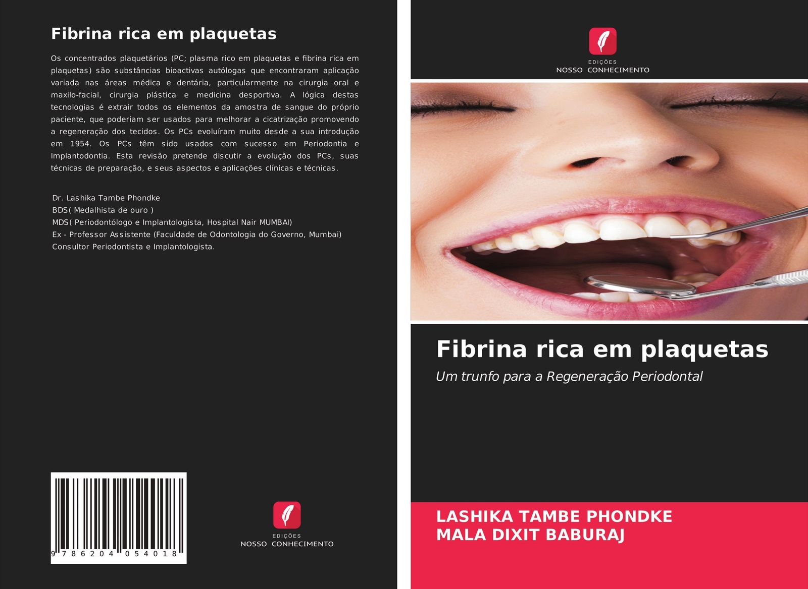 Lashika Tambe Phondke (u. A.) | Fibrina Rica Em Plaquetas |