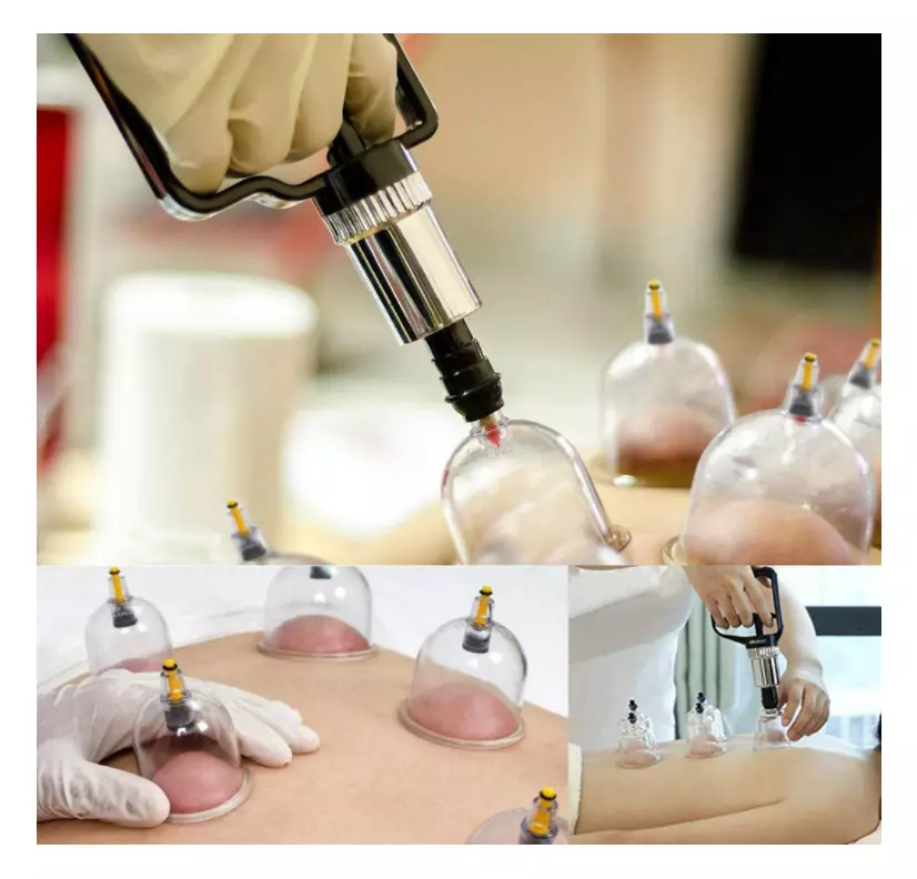 Ventosas De Acupuntura 22 Pcs Set Chinas Para Terapia Masajes Celulitis Masaje