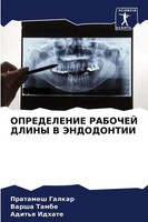 Pratamesh Galkar (U. A.) | Opredelenie Rabochej Dliny V Jendodontii | Buch