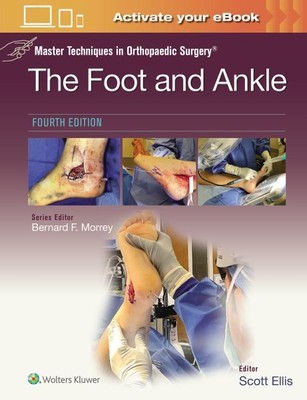 Meistertechniken in der orthopädischen Chirurgie: Fuß und Sprunggelenk, Hardcover von E...