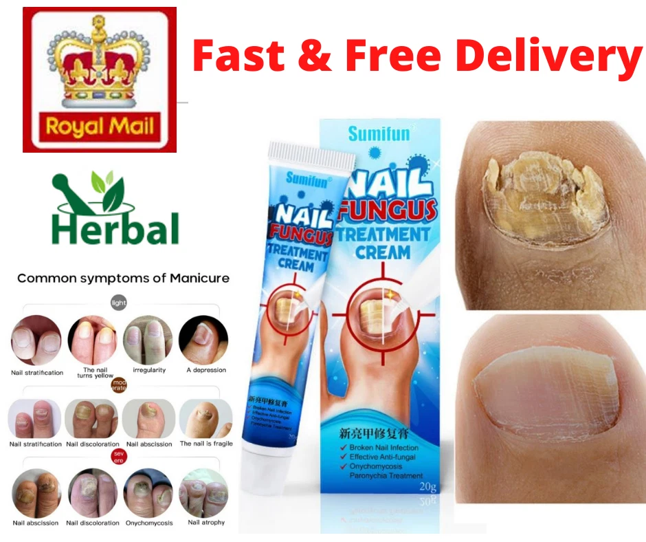 Nail 2024 fungal cream