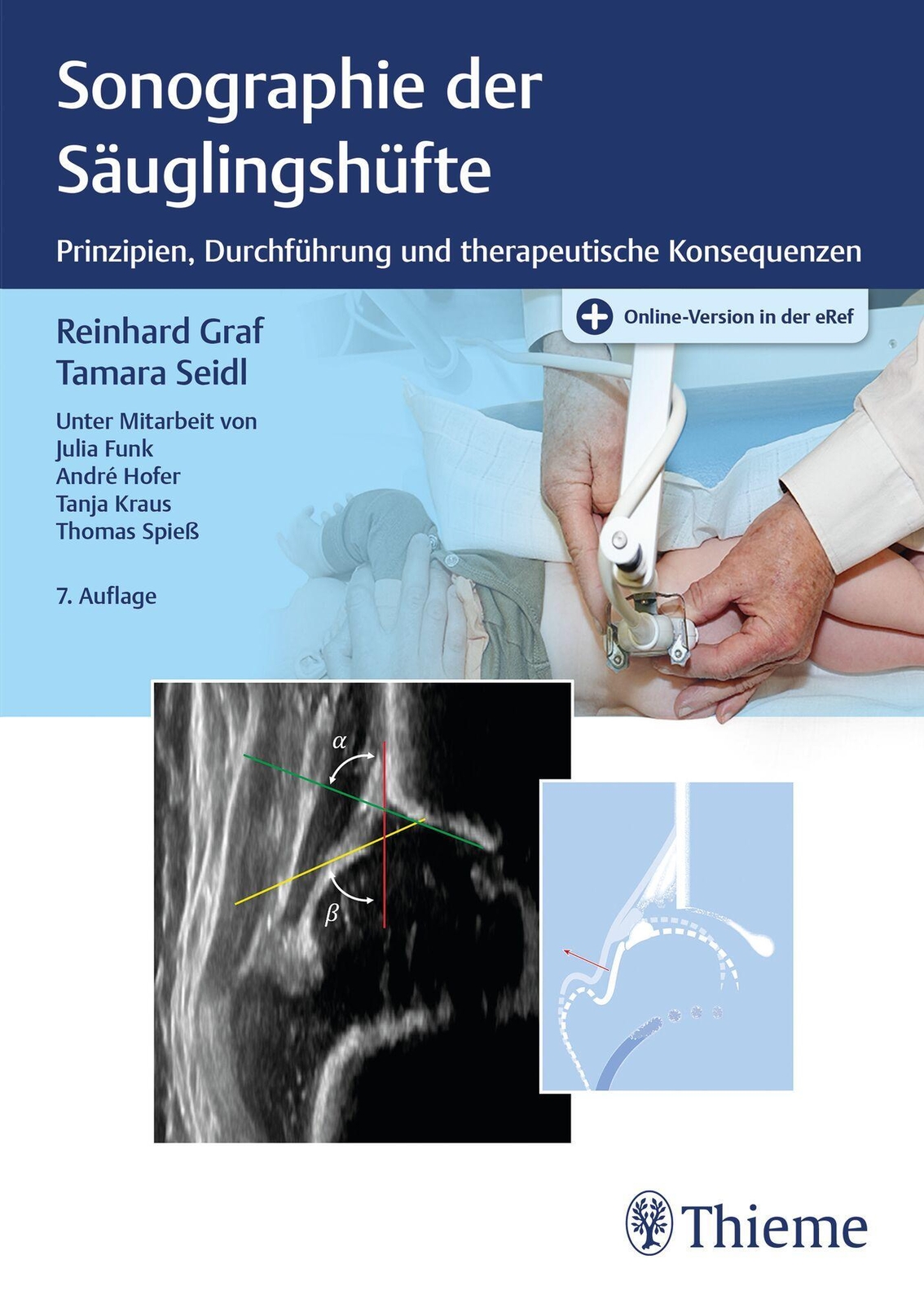 Thumbnail - Sonographie Der Säuglingshüfte Reinhard Graf (u. A.) Bundle Mixed