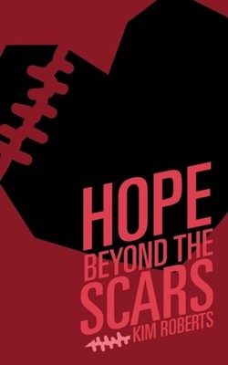 Roberts - Hope Beyond the Scars - paperback or softback - E555z