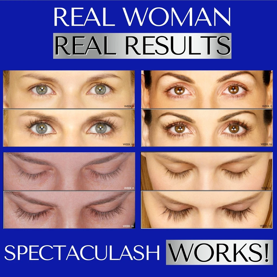 SPECTACULASH Eyelash Serum for Rapid Growth & Fullness – Results in 60 Days - Image 4 of 4