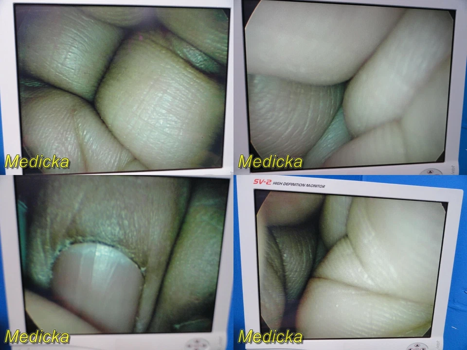 Telescopio rígido Karl Storz Hopkins II 26046 FA, autoclave 45° x 5mm x 29cm~23335 Foto 2 de 4