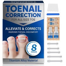 Ingrown Toenail Treatment, Toenail Correction Strips for Curved or Ingrown Nails