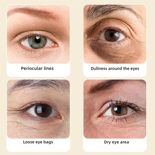VC Lutein Eye Essence Oil Re lieves Eye Fatigue DinKiss VC Eye Lutein 1-5 Box - Picture 12 of 22