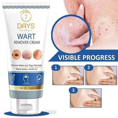 7 Days Genital Wart Removal Treatment Cream Suitable for All Types of Skin 50gm