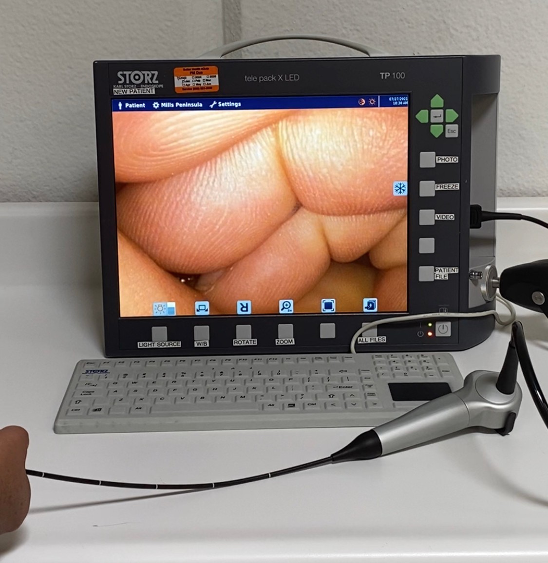 STORZ 11101VN VIDEO NASOLARYNGOSCOPE