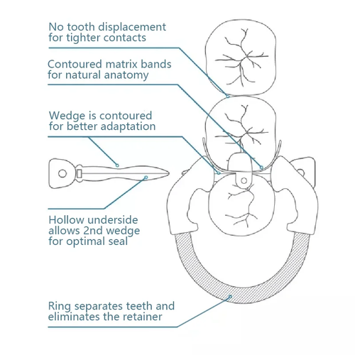 Dental Matrix Bands Ring Sectional Matrice Clamp Fit Garrison Palodent V3 System - Picture 6 of 39