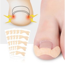 1sheet Ingrown Toe Foot Nail Correction Sticker Pedicure Toenail Corrector.t2
