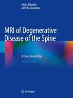 Paola D'aprile (U. A.) | MRI Of Degenerative Disease Of The Spine | Taschenbuch