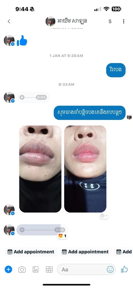 MT Dark Lip Solution 5g (គ្រីមព្យាបាលបូរមាត់ខ្មៅ MT) 5g Foto 3 de 4