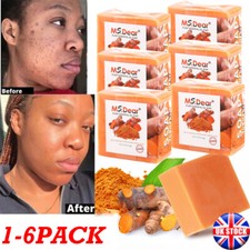 Natural Turmeric Soap Bar, Acne & Brightening, Skin Whitening Dark Spots Removal