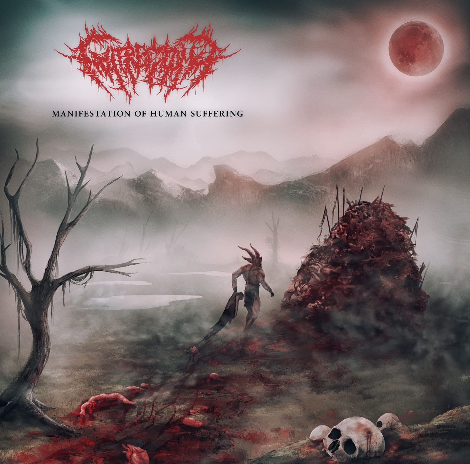 Gutrectomy Manifestation Of Human Suffering (CD)