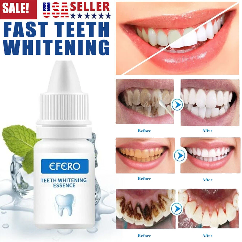Efero Teeth Whitening Essence 10ml Price In Nigeria Konga, 47 OFF