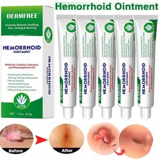 5xHemorrhoid  Fissure Ointment Hemorrhoids Treatment Internal Piles Pain Relief