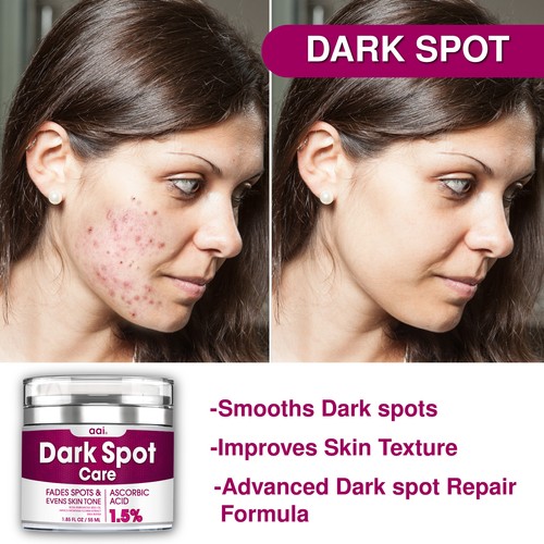 Dark Spot Care Corrector Cream –Effective Dark Spot Remover for Face, Neck, Body - Picture 4 of 15